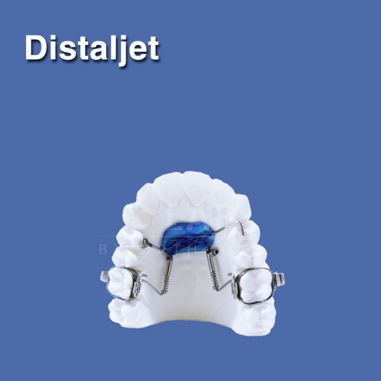 Distalisation Jet Distaljet - Aparatología Disyunción Lab by OrthoLab