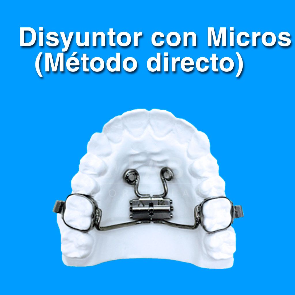 Disyuntor con Microtornillos (Método Directo) Aparatologia ortodoncia con microtornillos