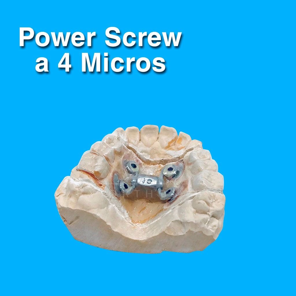 power Screw a 4 Micros Aparatologia Ortodoncia con Microtornillos