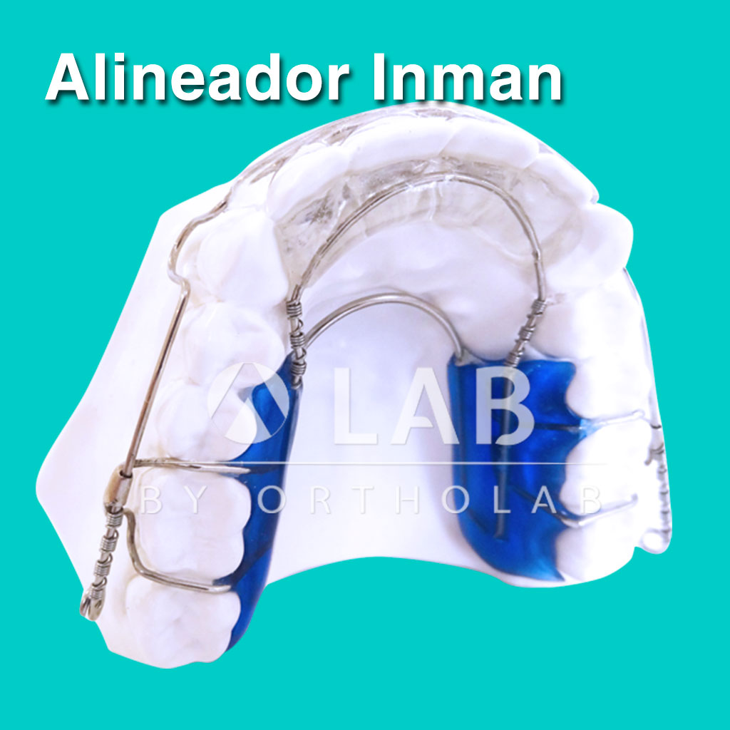 Alineador Inman Placas Activas Aparatología Ortodoncia
