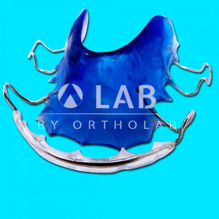 Placa Arco con Resina Aparatologia Ortodoncia Retencion