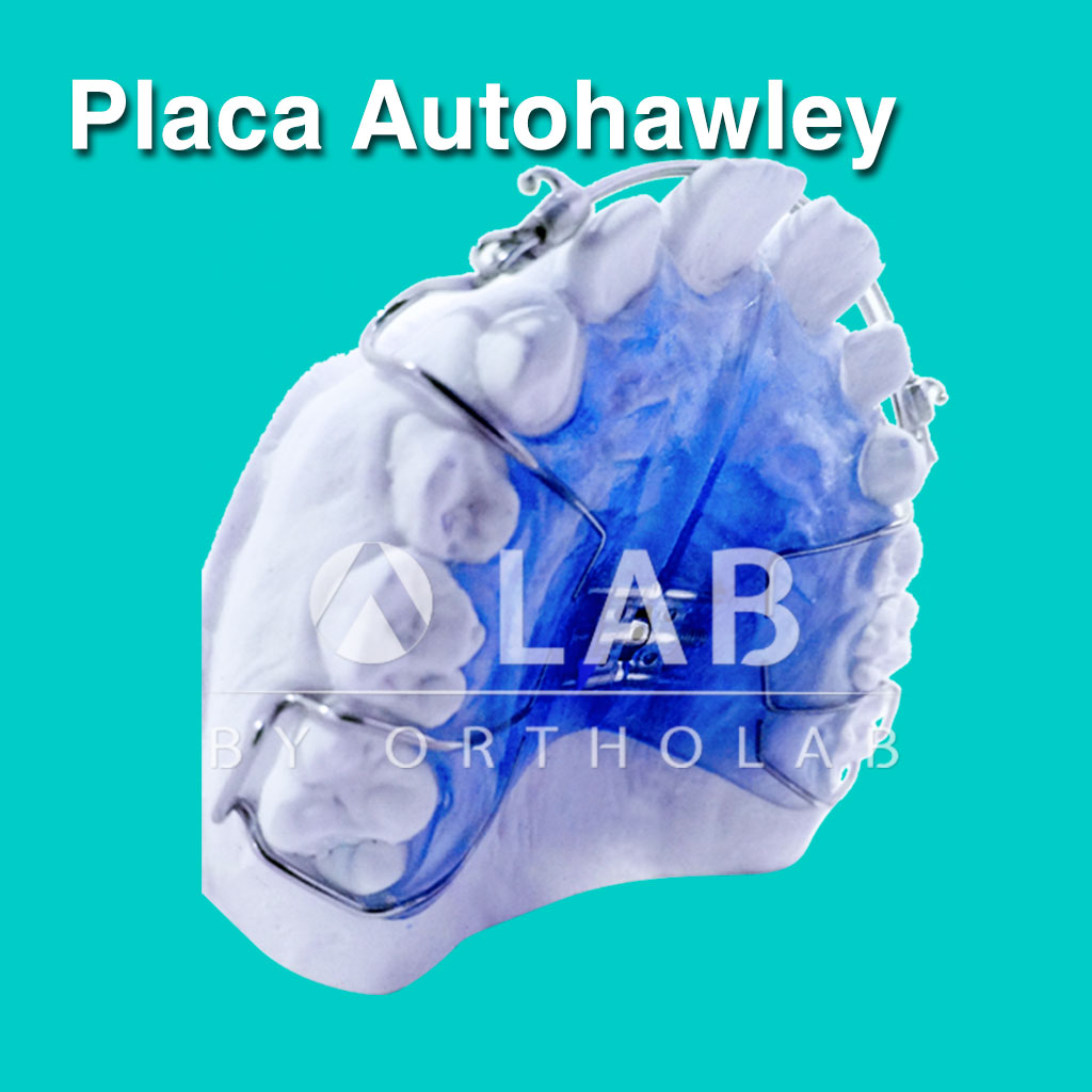 Placa Auto Hawley Aparatolgia Ortodoncia Placas Activas