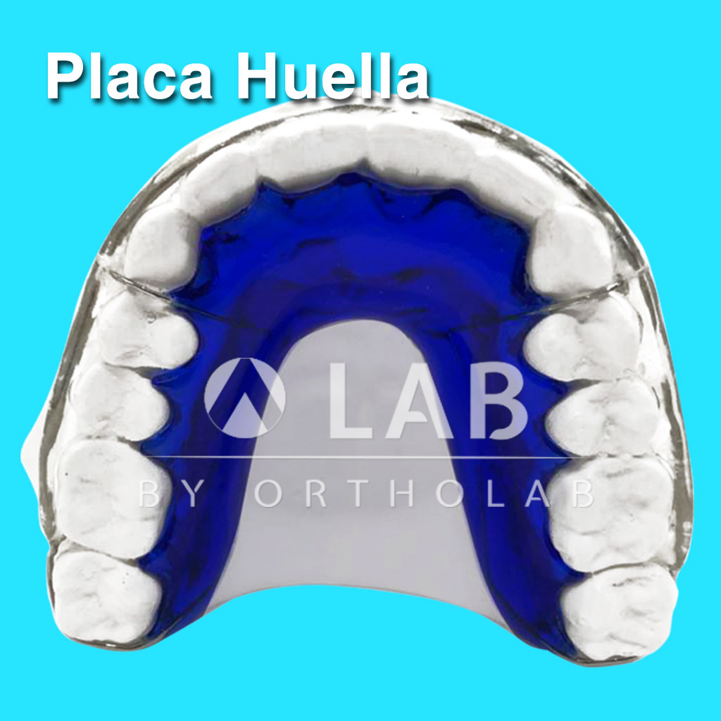Placa Huella Aparatologia Ortodoncia Retencion