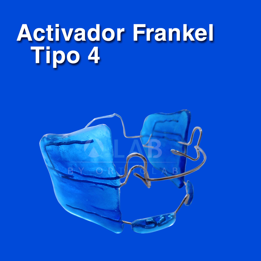 Activador Frankel Tipo 4 - Aparatología Ortodoncia Funcional