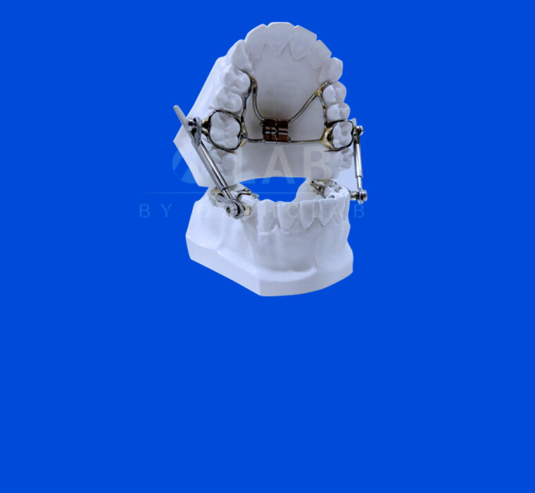 Activador Herbst con Disyuntor - Aparatología Ortodoncia Funcional