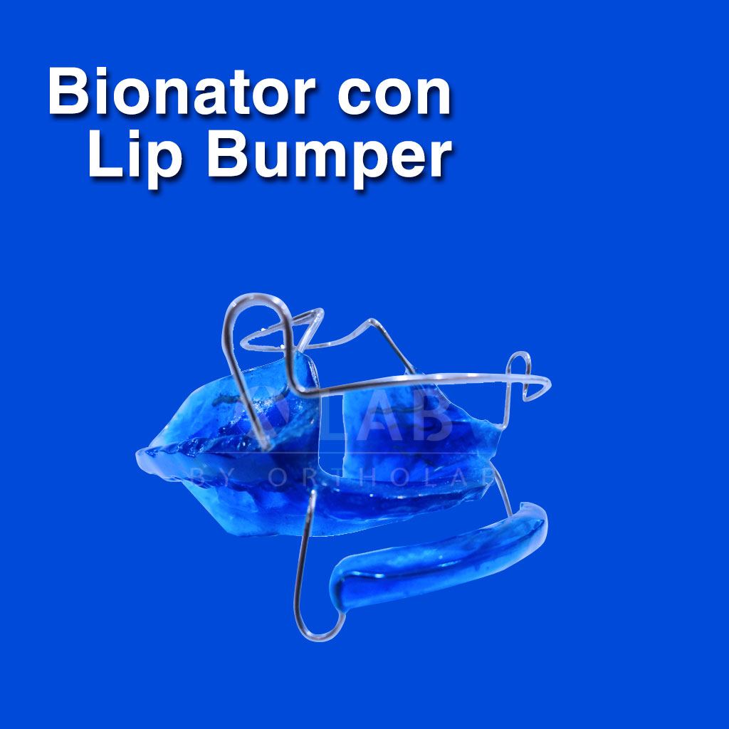 Bionator con Lip Bumper - Aparatología Ortodoncia Funcional