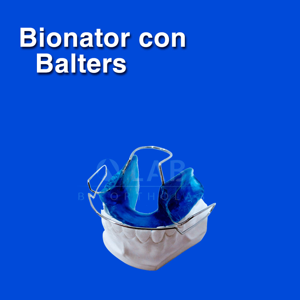 Bionator con Balters - Aparatología Ortodoncia Funcional