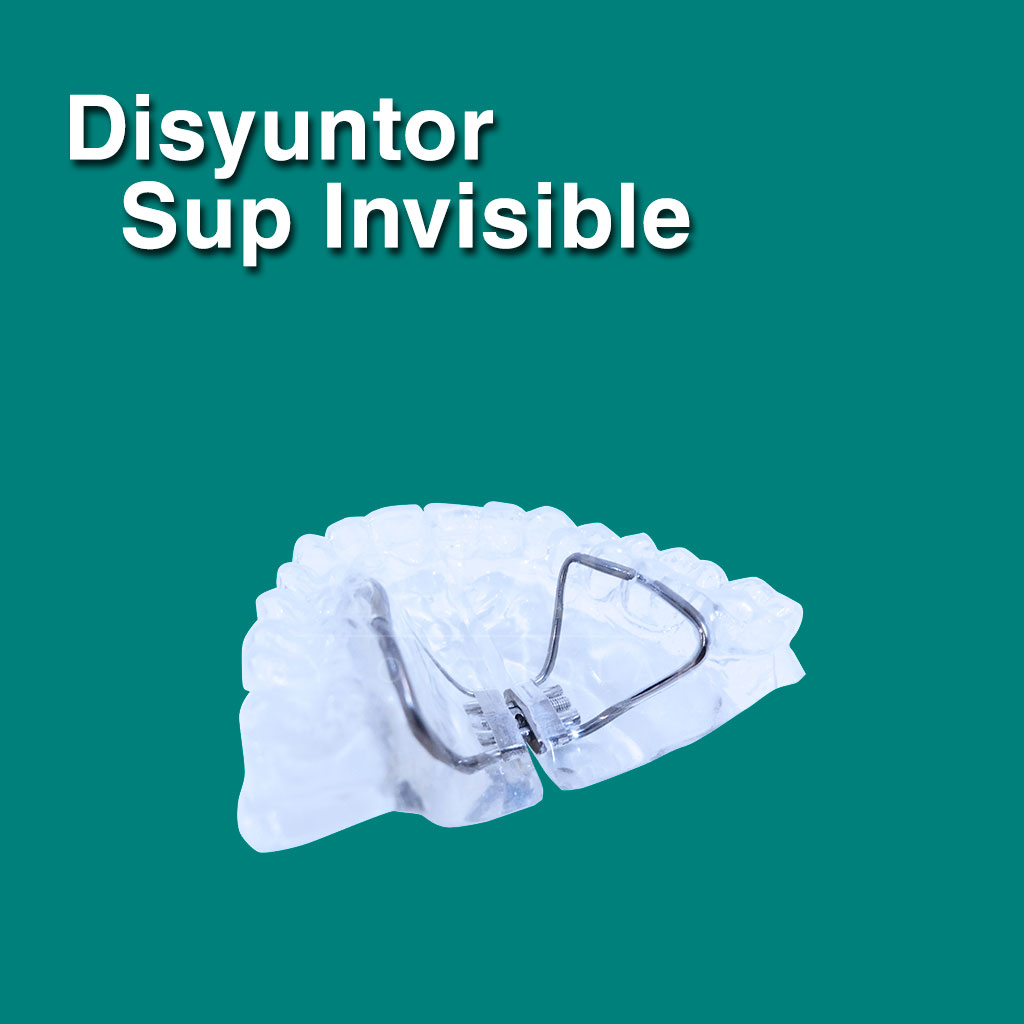 Disyuntor Superior Invisible - Ortodoncia invisible