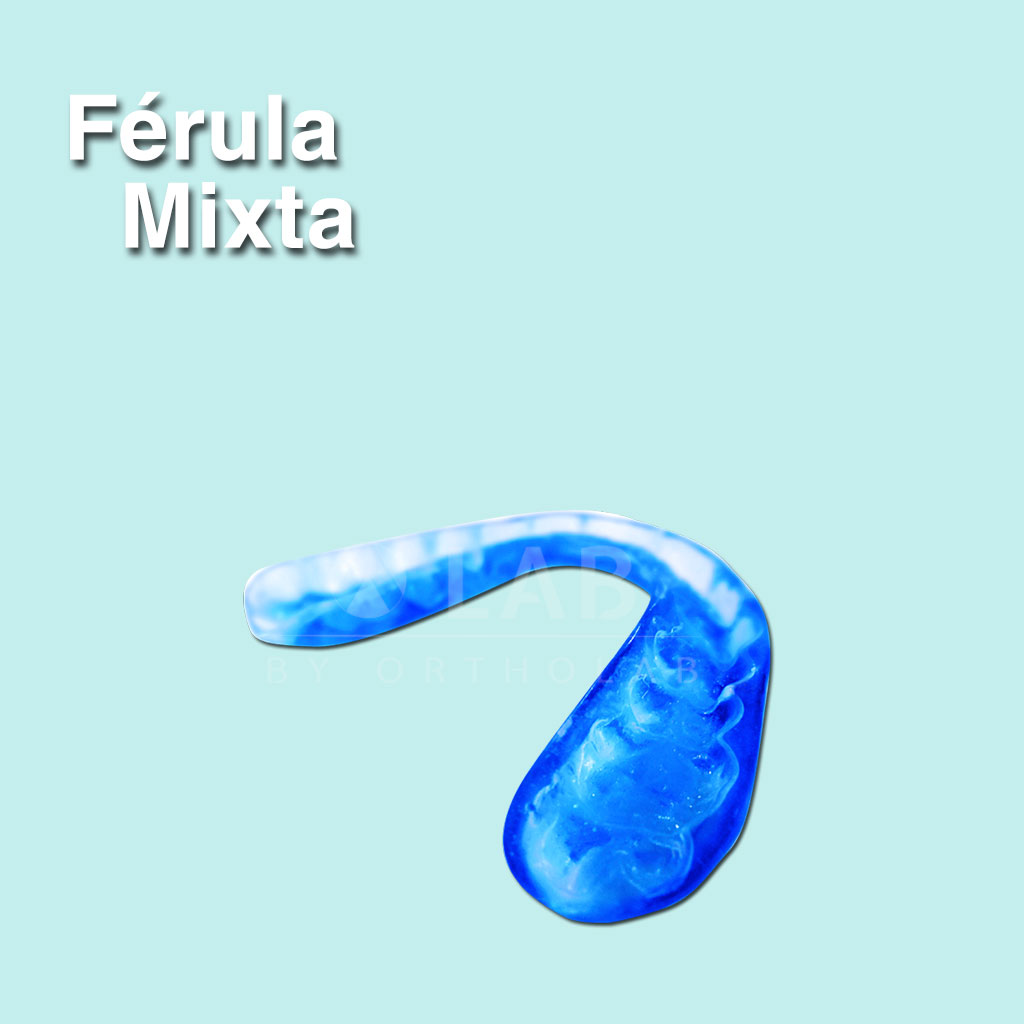 Férula mixta - Férulas de Ortodoncia y ATM