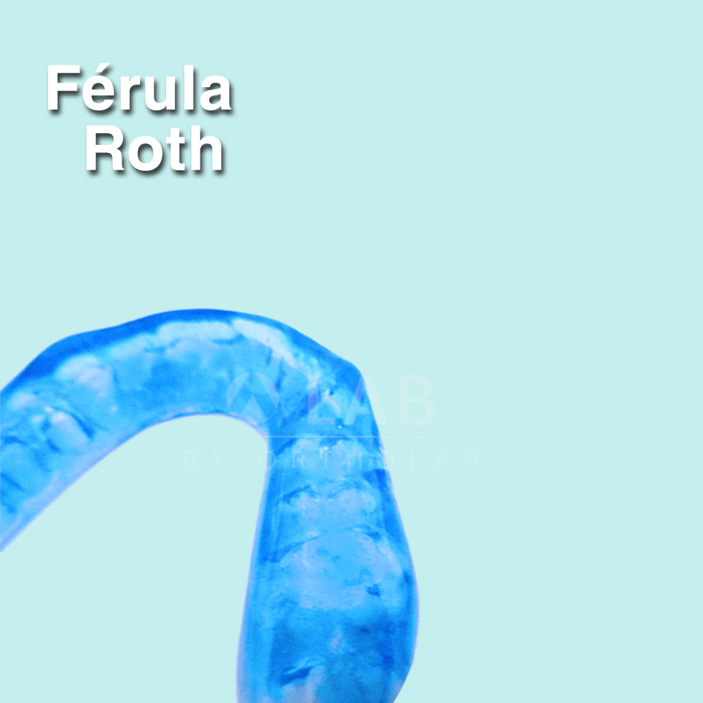 Férula Roth interior - Férulas de Ortodoncia y ATM