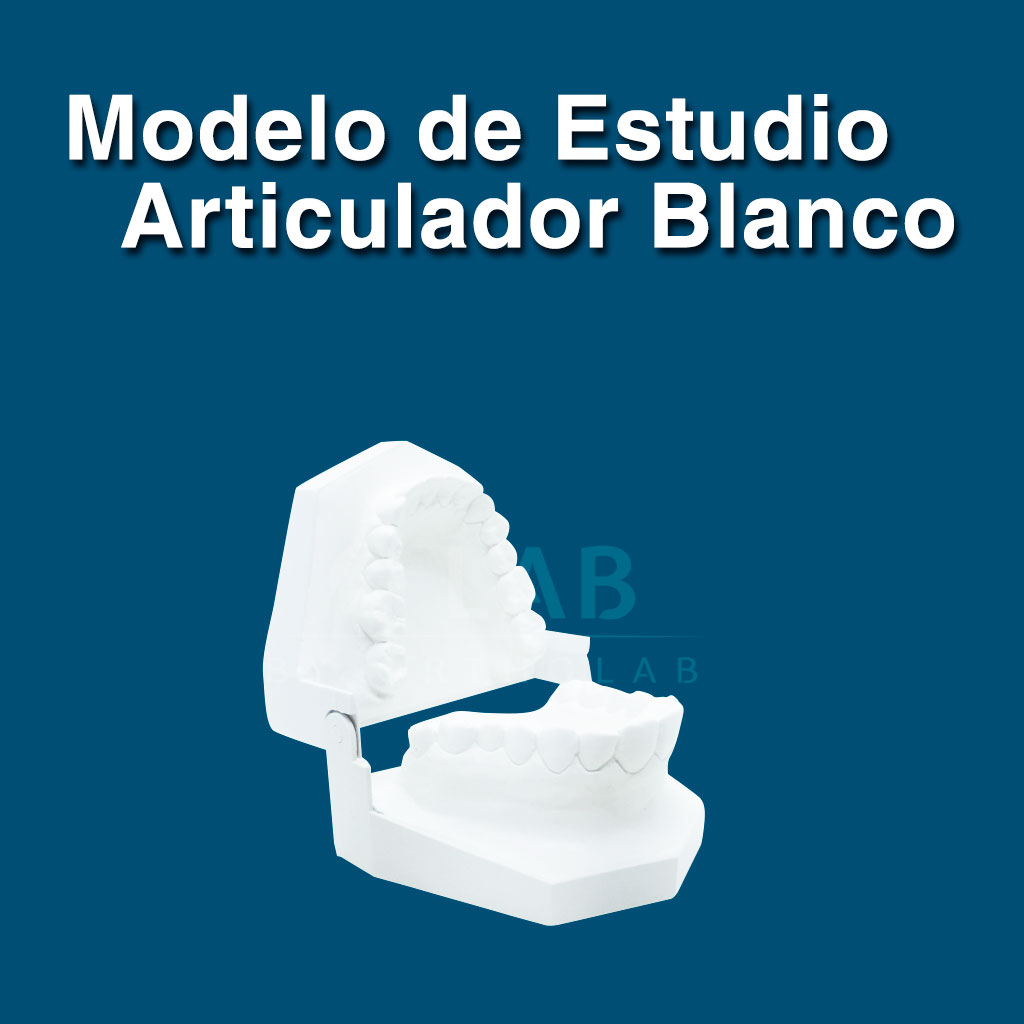 Modelo de estudio en articulador blanco - Complementos de aparatología de Ortodoncia