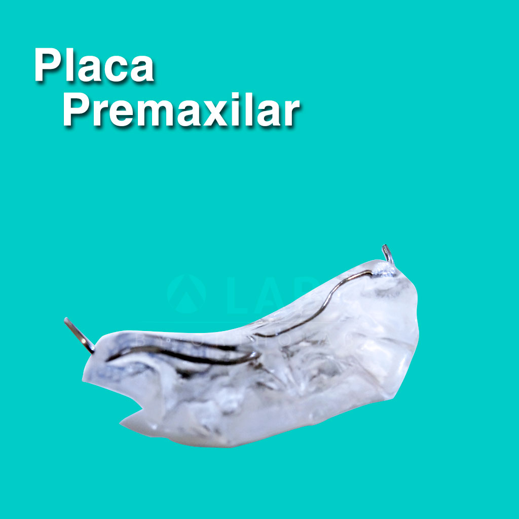 Placa Premaxilar - Aparatología Placas Activas