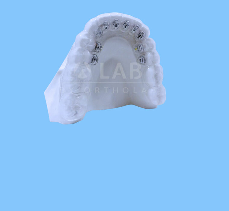 Posicionador de brackets linguales - Ortodoncia lingual