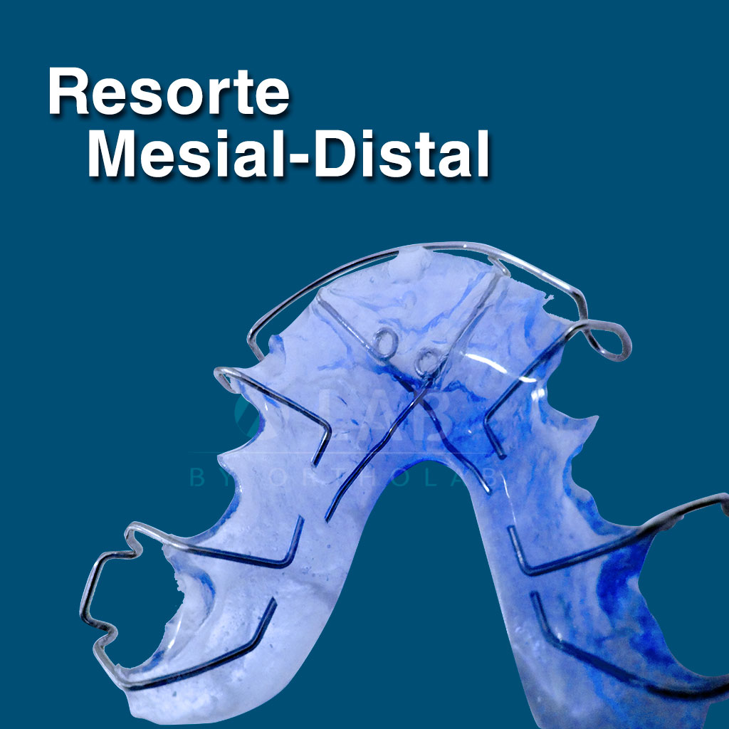 Resorte Mesial-Distal - Complementos de aparatología de Ortodoncia