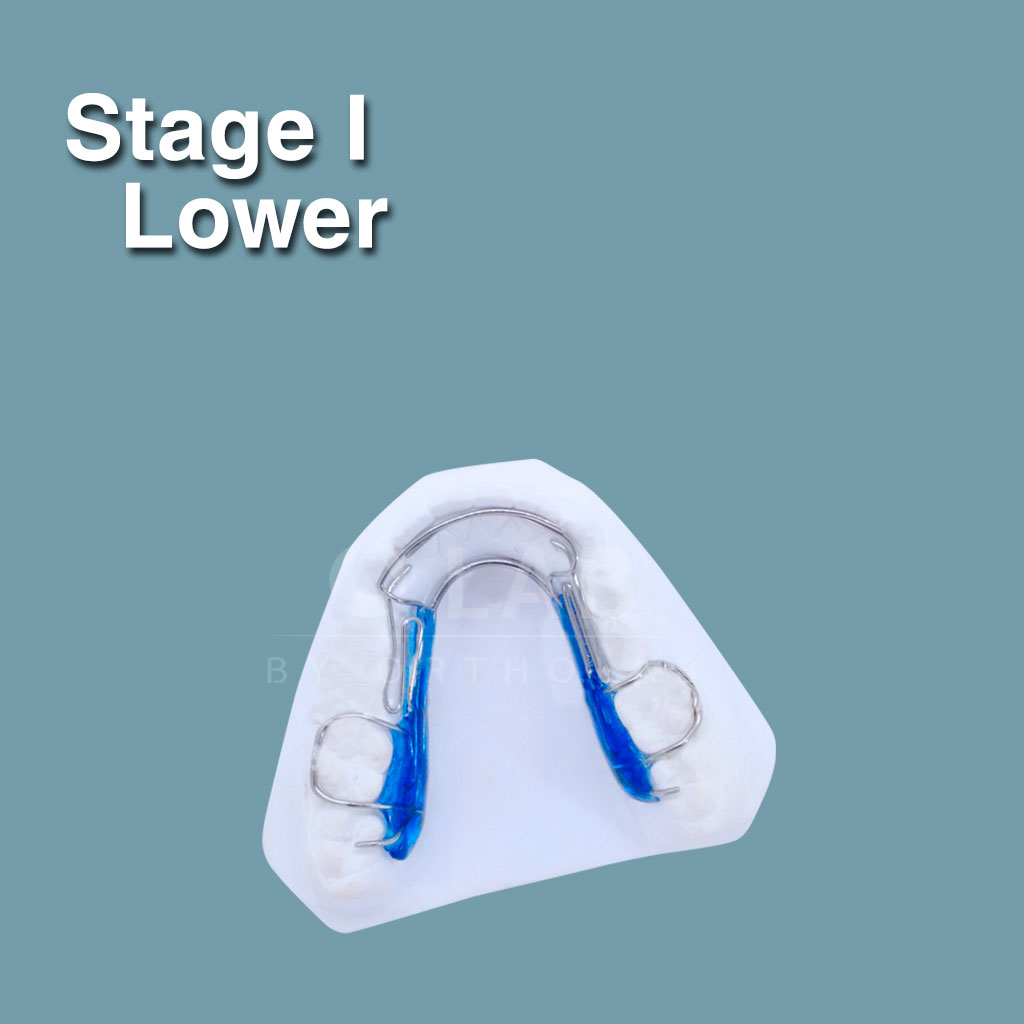 Stage I Lower - Orthotropics aparatología de Ortodoncia