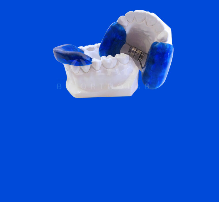 Twin Block - Aparatología Ortodoncia Funcional