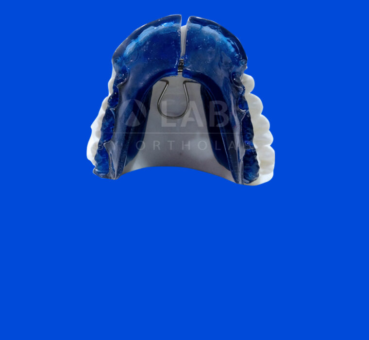 Bionator - Aparatología Ortodoncia Funcional